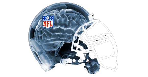 NFL football helmet